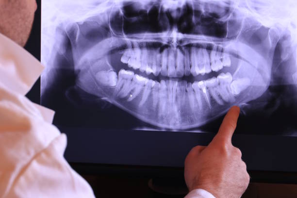 Best Emergency Root Canal Treatment in Stuarts Draft, VA